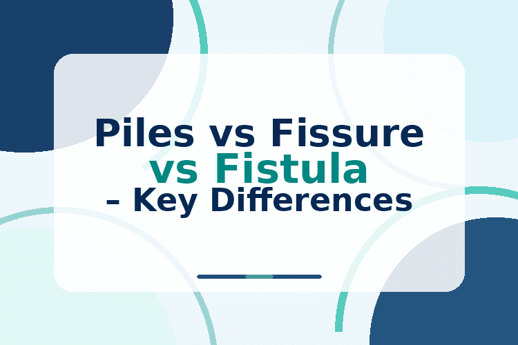 Piles vs Fissure vs Fistula – Key Differences